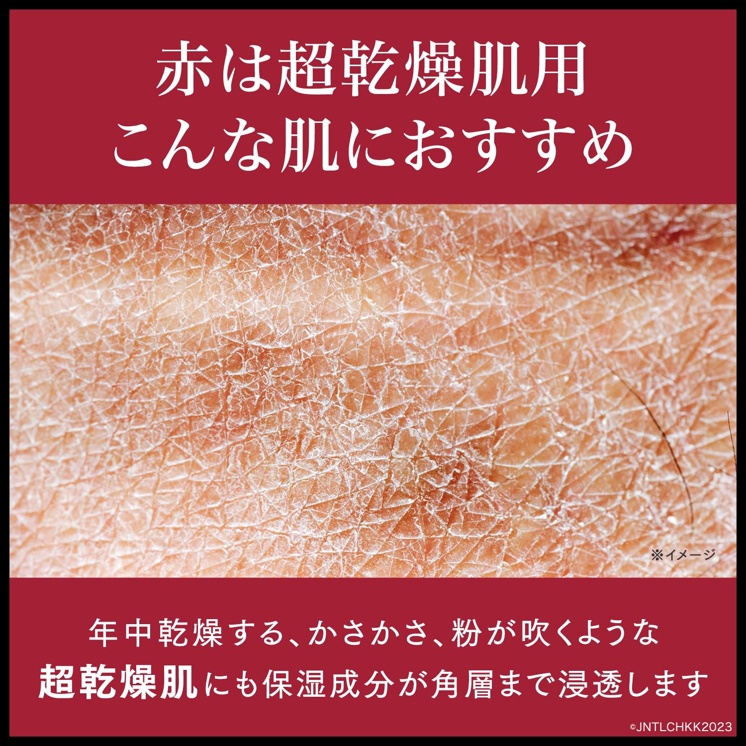 Neutrogena Norwegian Formula Intense Repair Body Cream for Extra Dry Skin 450ml- Japan Figure Store - #1 Bring To You The Best Japanese Goods